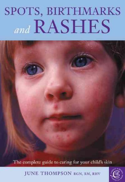 Spots, birthmarks and rashes : the complete guide to caring for your child's skin / June Thompson.